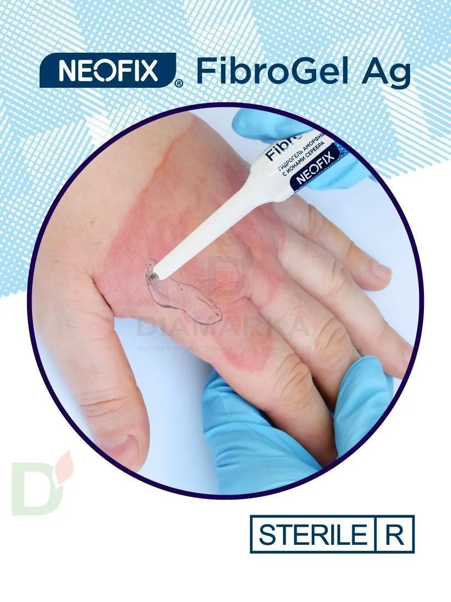 Гидрогель антимикробный NEOFIX FibroGel Fg с ионами серебра 15г в Волгограде